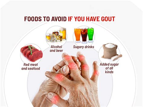 Best Food for Gout: What To Eat and What To Avoid.